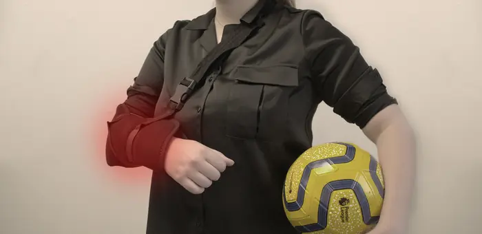 Arm supported in a sling after a fracture